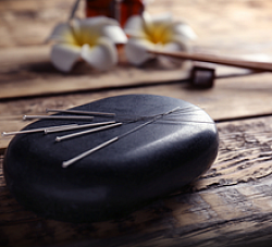 Aiguilles médecine chinoise